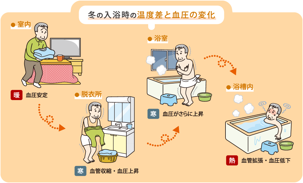 冬の入浴時の温度差と血圧の変化
